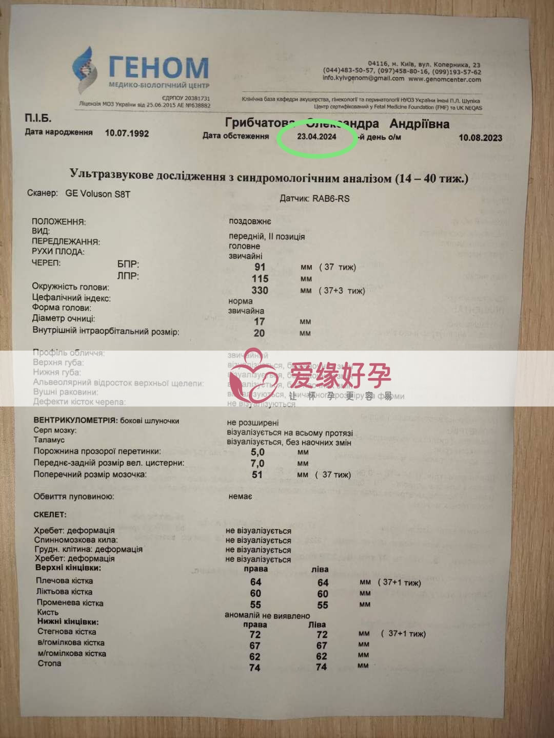 爱缘好孕：乌克兰代孕代母37周孕检顺利通过