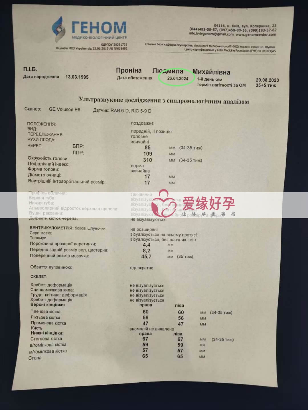 爱缘好孕: 乌克兰代孕代母34周孕检顺利通过