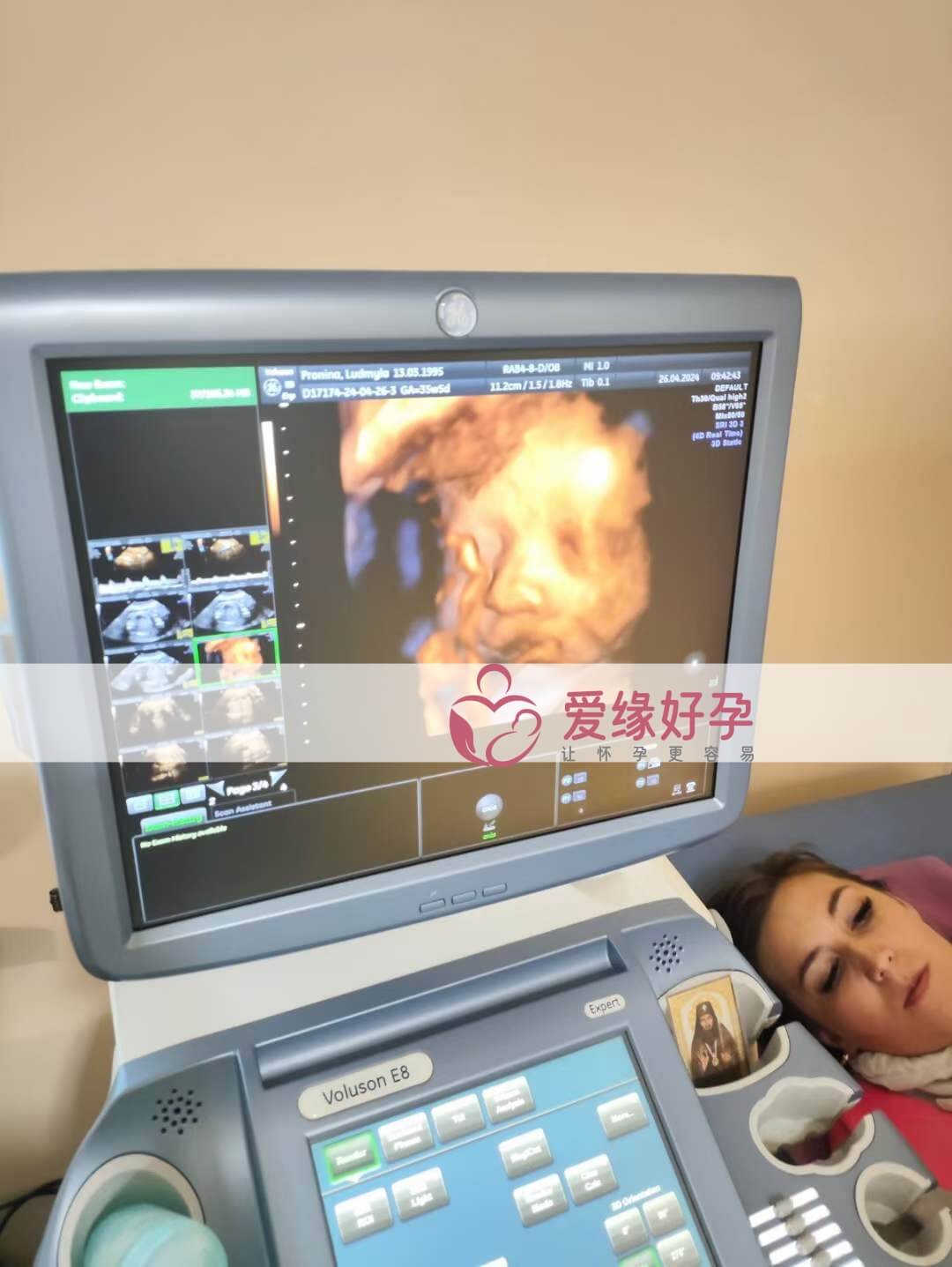 爱缘好孕: 乌克兰代孕代母34周孕检顺利通过