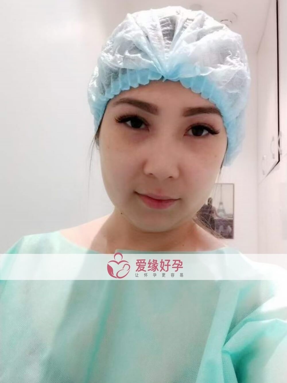 爱缘好孕:哈萨克斯坦代孕代母今天移植一颗4BA囊胚