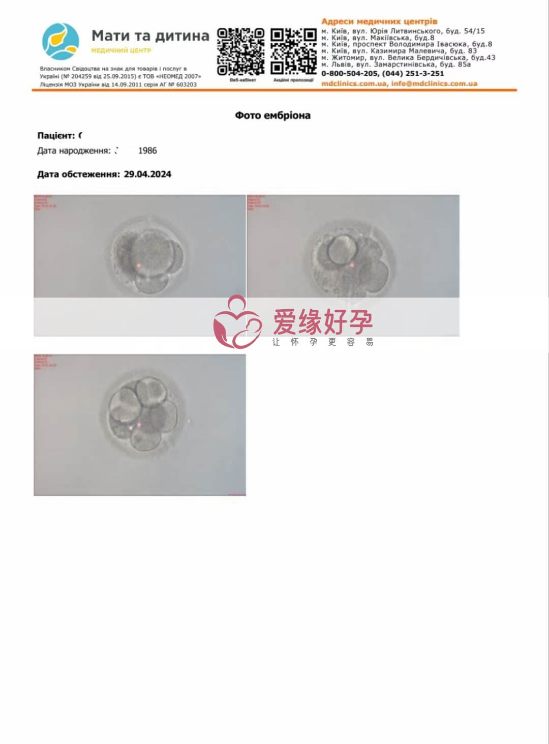 爱缘好孕:乌克兰代孕代母今天移植3颗三天的初级胚胎
