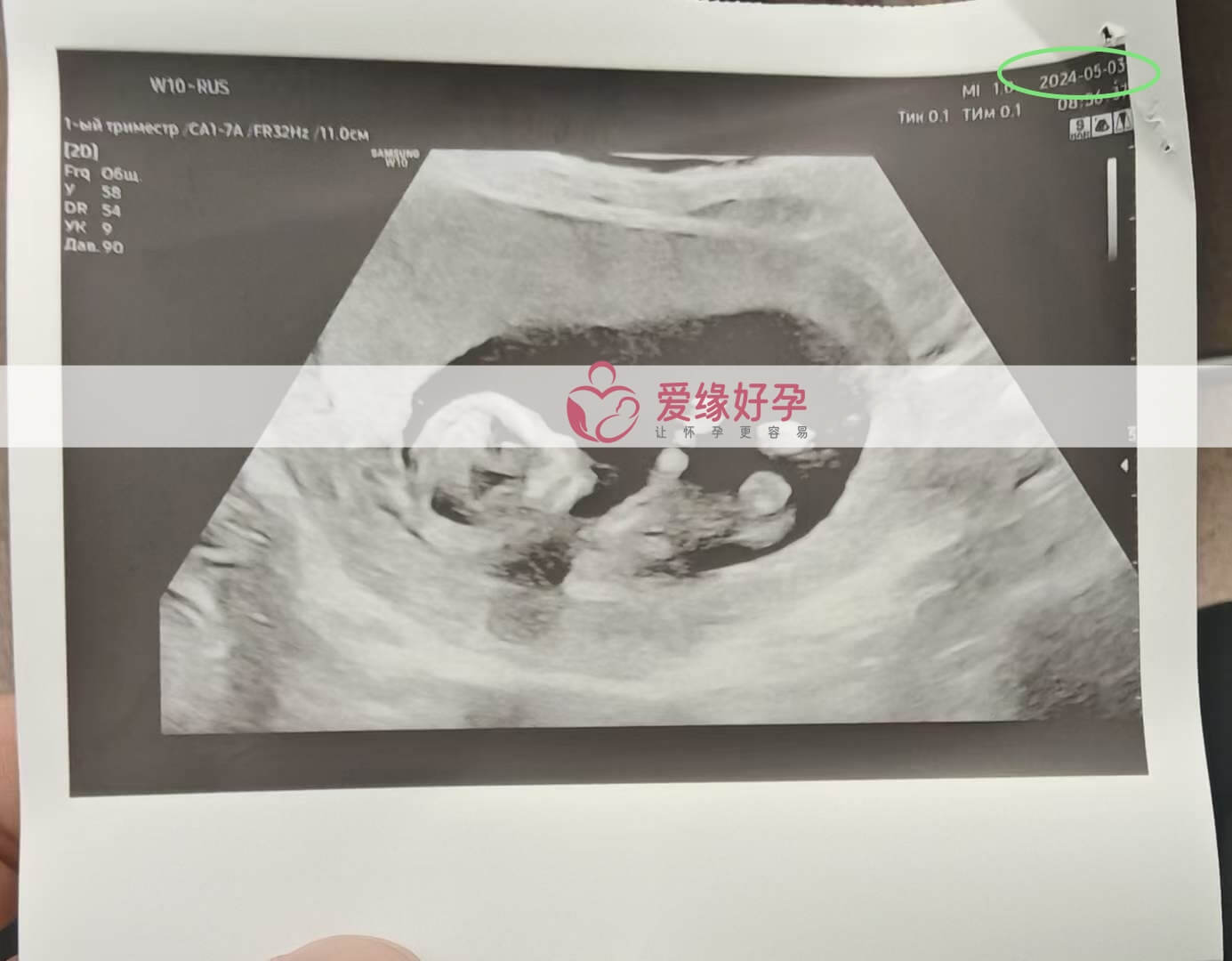 爱缘好孕:哈萨克斯坦代孕代母12周孕检顺利通过