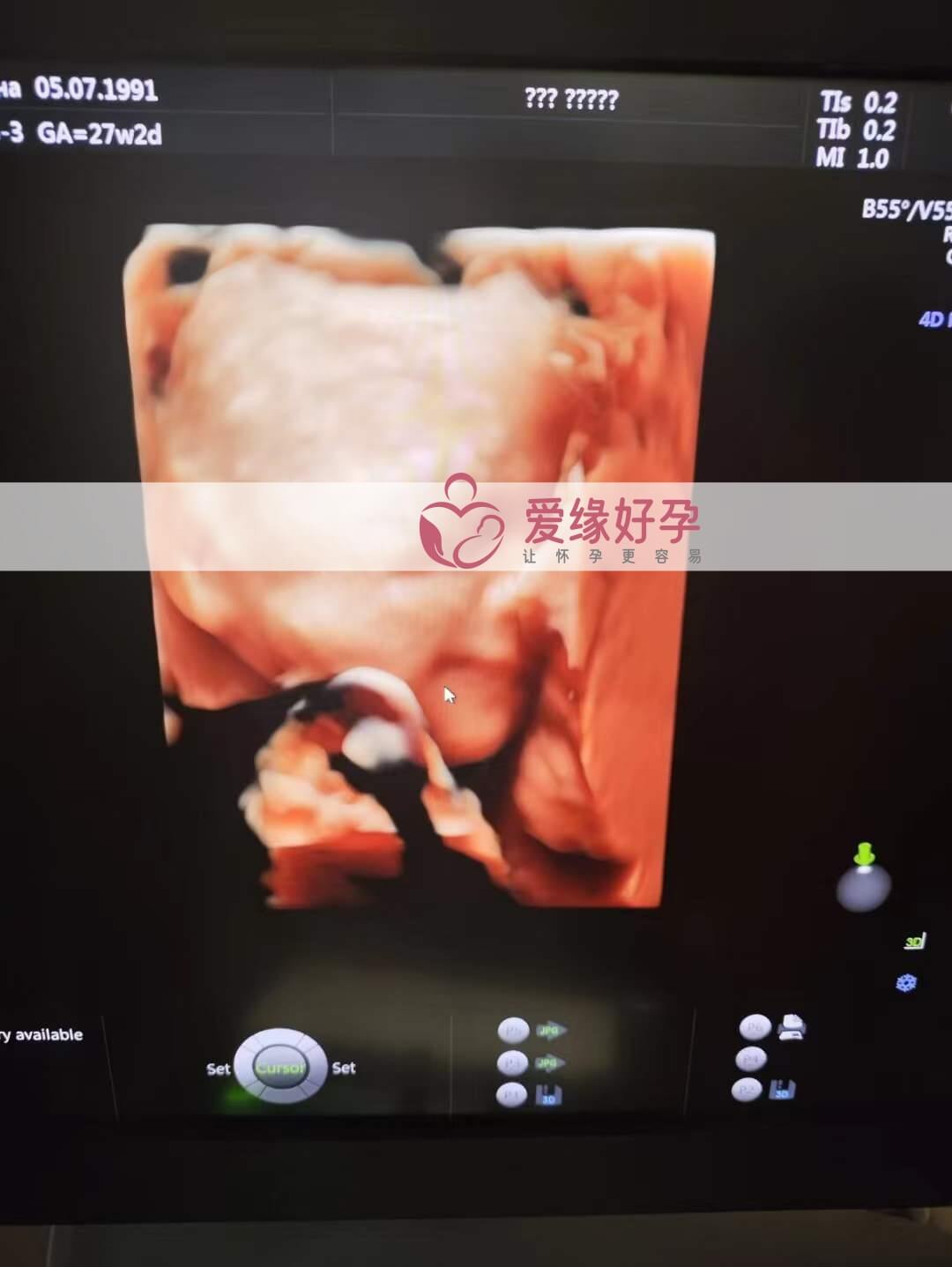 爱缘好孕:乌克兰代孕代母孕28周产检顺利通过