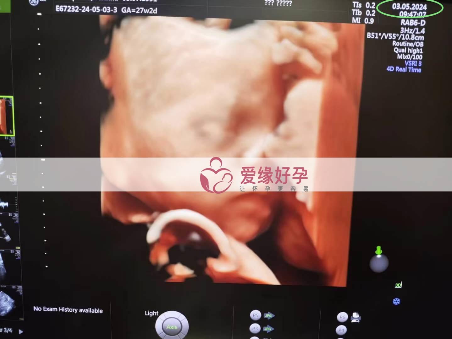 爱缘好孕:乌克兰代孕代母孕28周产检顺利通过