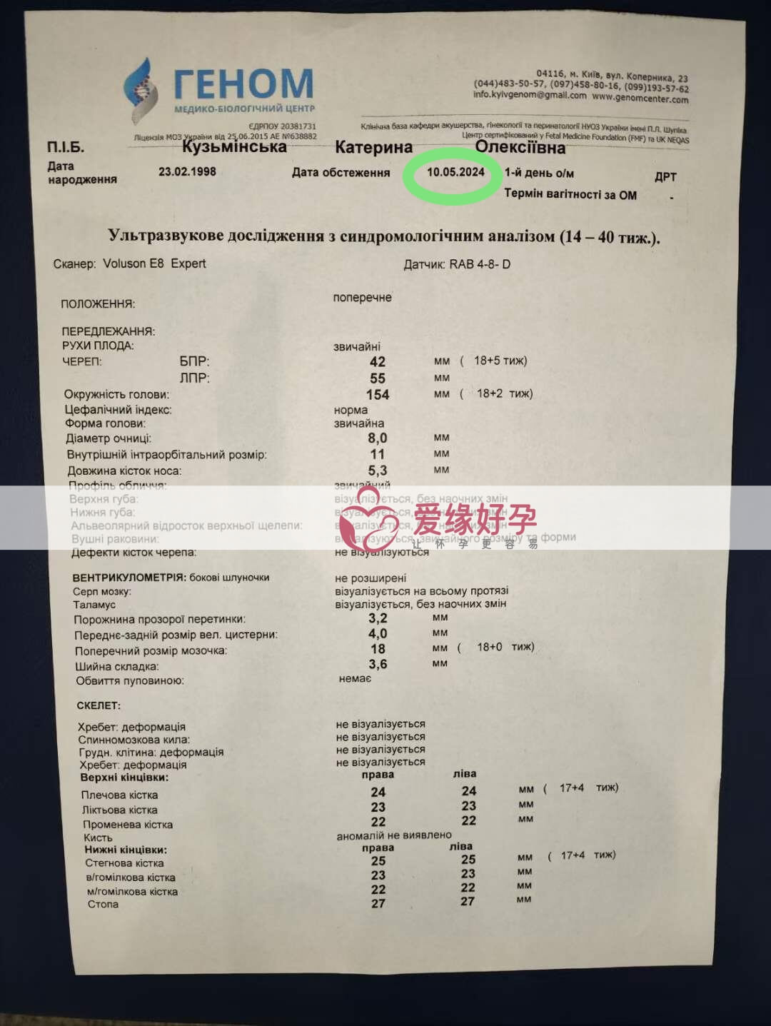 爱缘好孕:乌克兰代孕代母第18周孕检通过