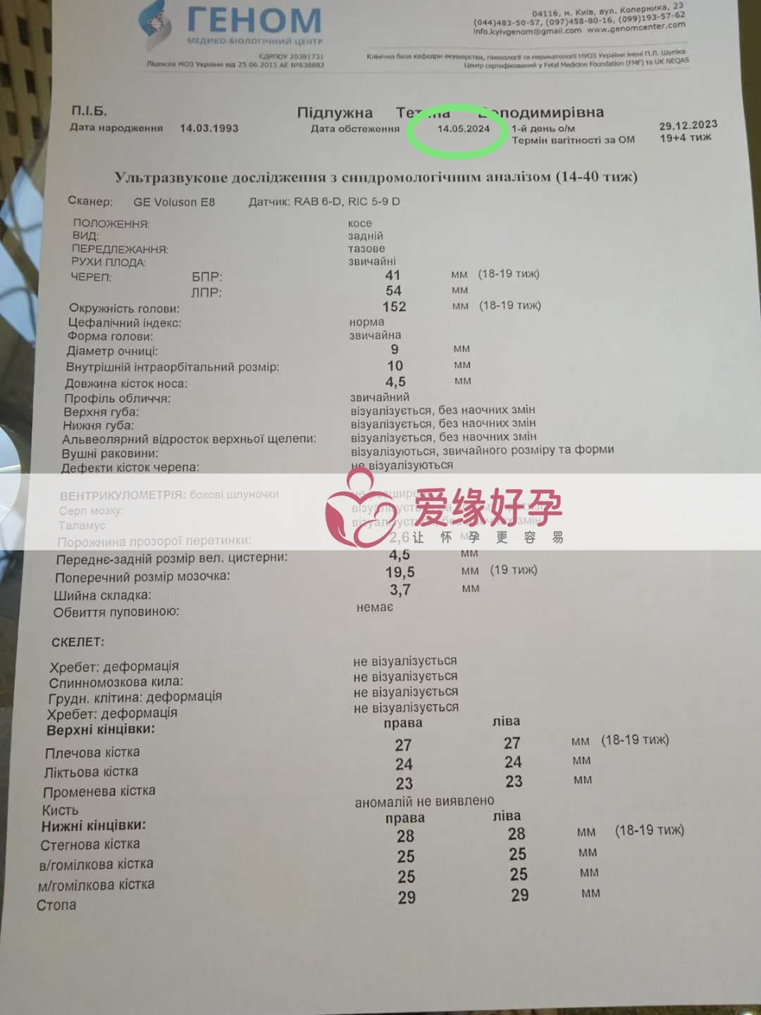 爱缘好孕:乌克兰代孕代母18周孕检顺利通过