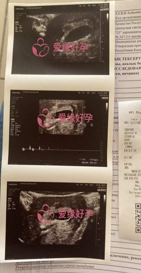 爱缘好孕:乌克兰代孕代母6周孕检顺利通过