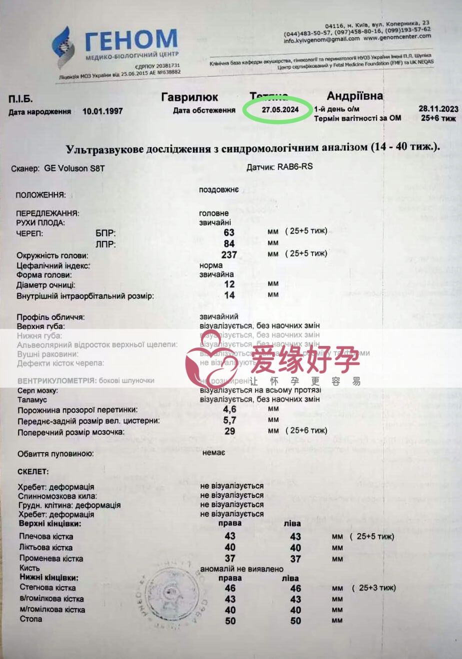 爱缘好孕:乌克兰代孕代母25周孕检顺利通过