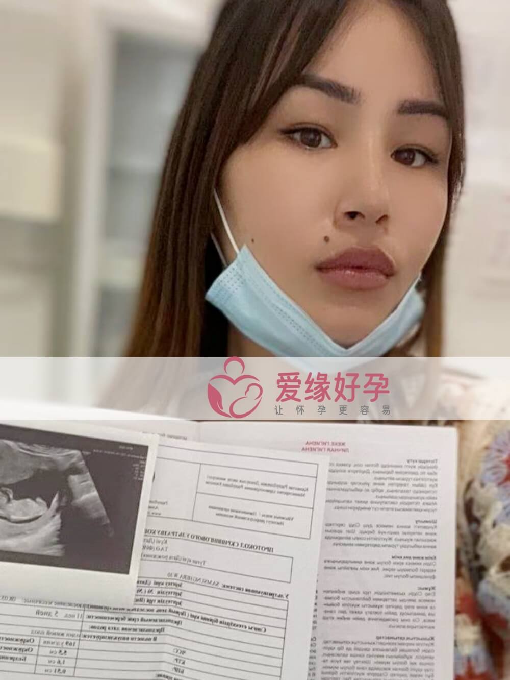 爱缘好孕:哈萨克斯坦代孕代母早期唐筛顺利通过