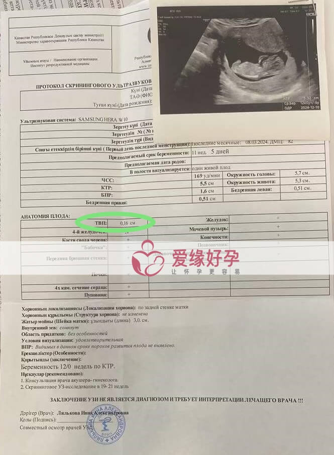 爱缘好孕:哈萨克斯坦代孕代母早期唐筛顺利通过