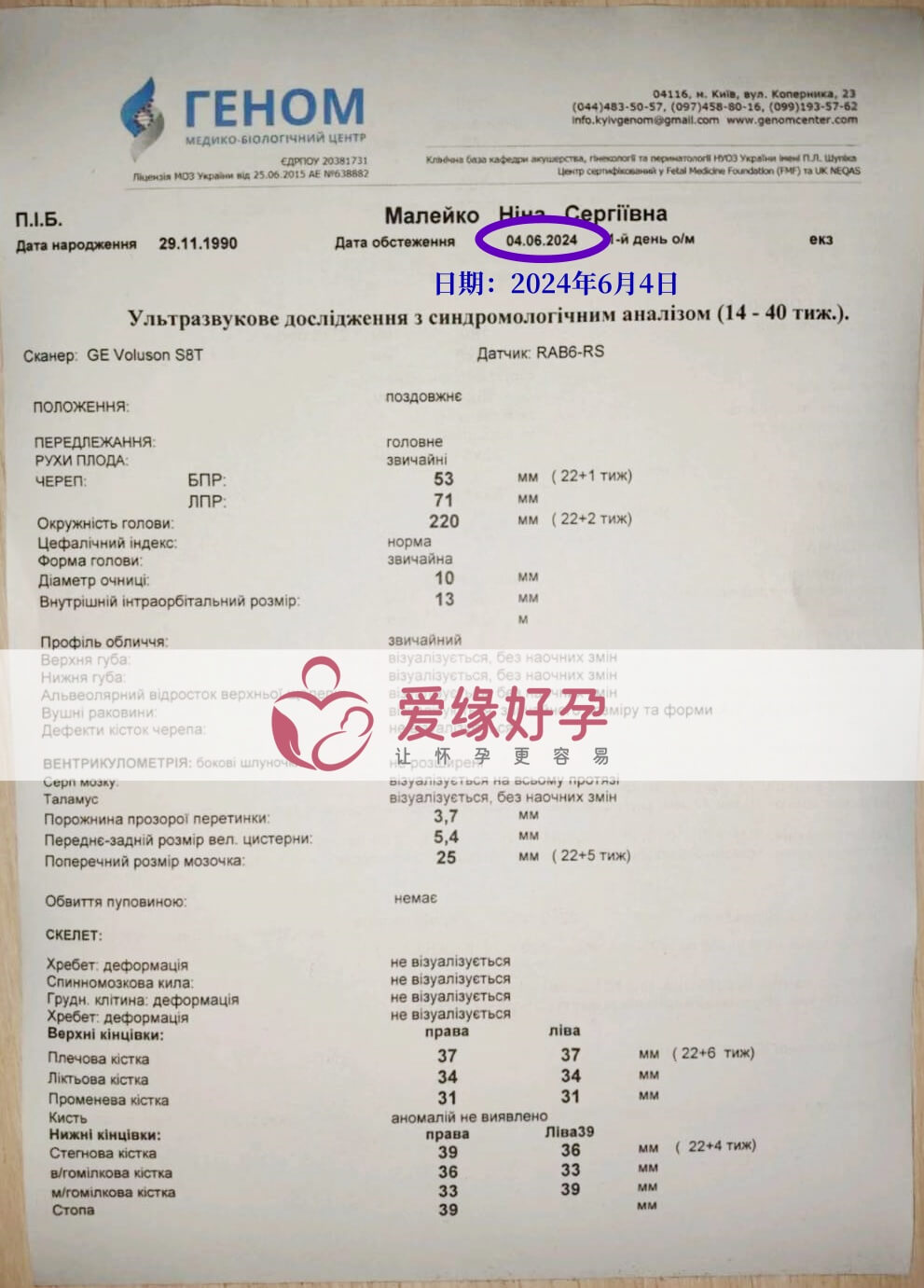 爱缘好孕:乌克兰代孕代母孕22周产检顺利通过