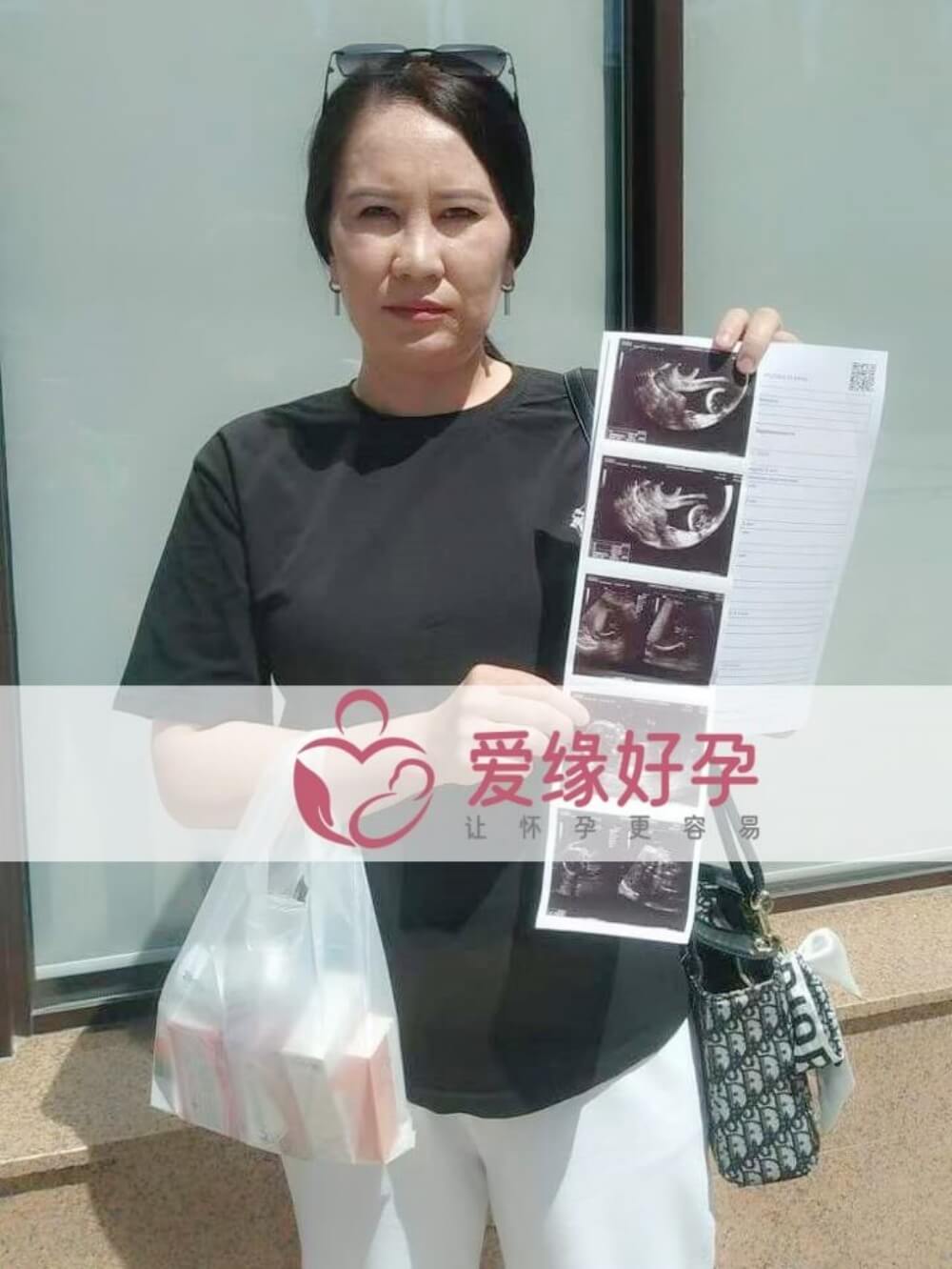 爱缘好孕:哈萨克斯坦代孕代母孕19周+产检顺利通过