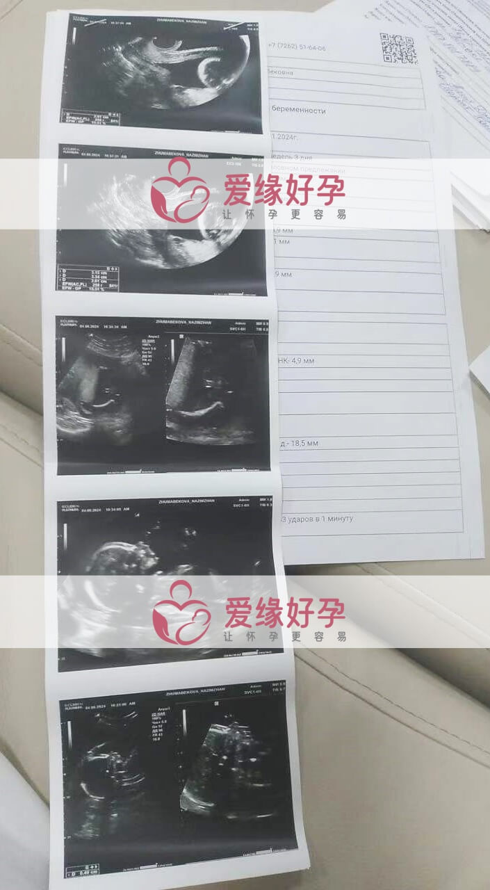 爱缘好孕:哈萨克斯坦代孕代母孕19周+产检顺利通过