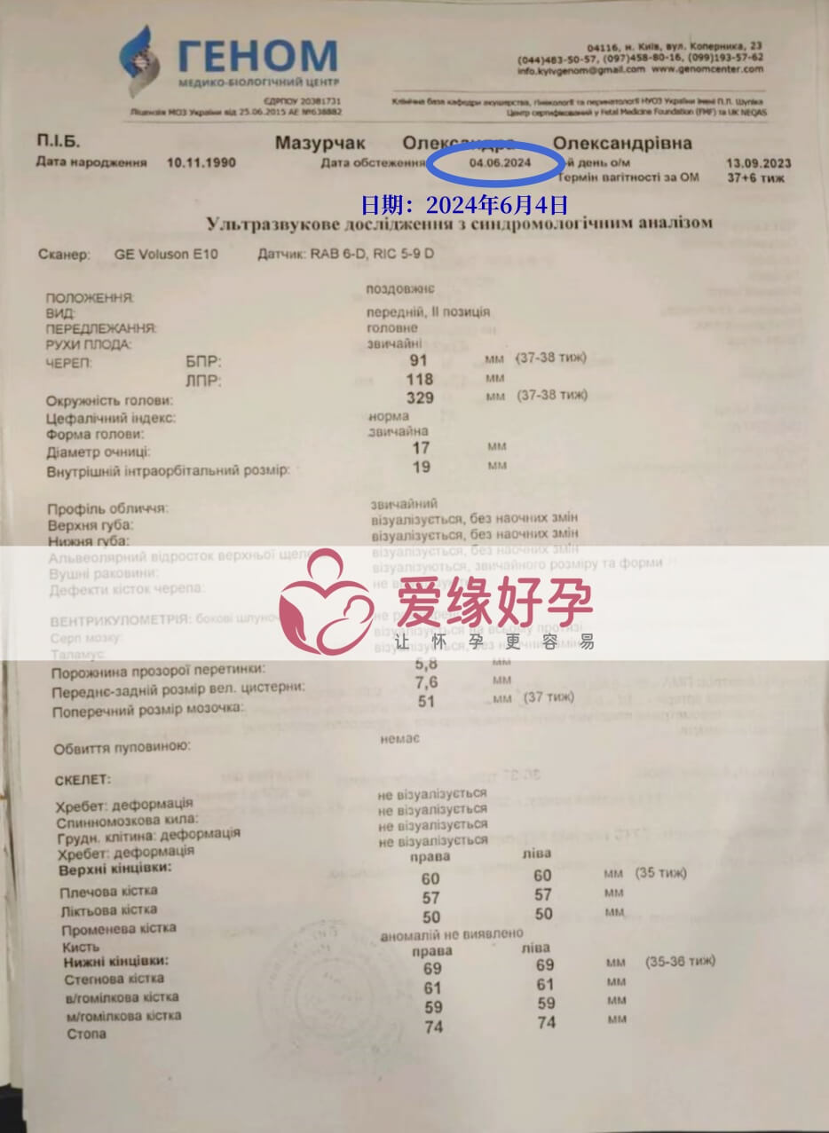 爱缘好孕:乌克兰代孕代母孕37周产检顺利通过