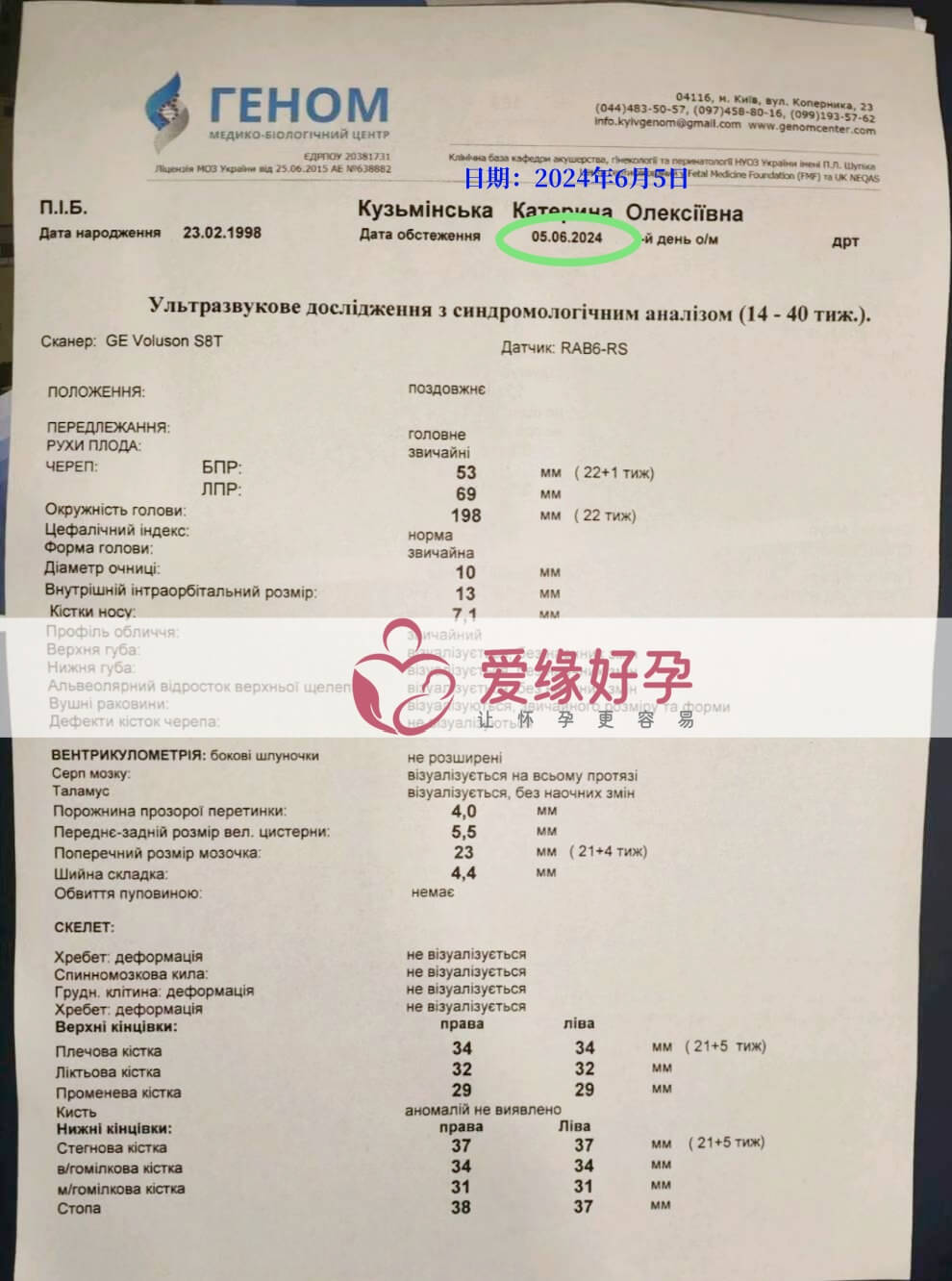 爱缘好孕:乌克兰代孕代母孕21周产检顺利通过