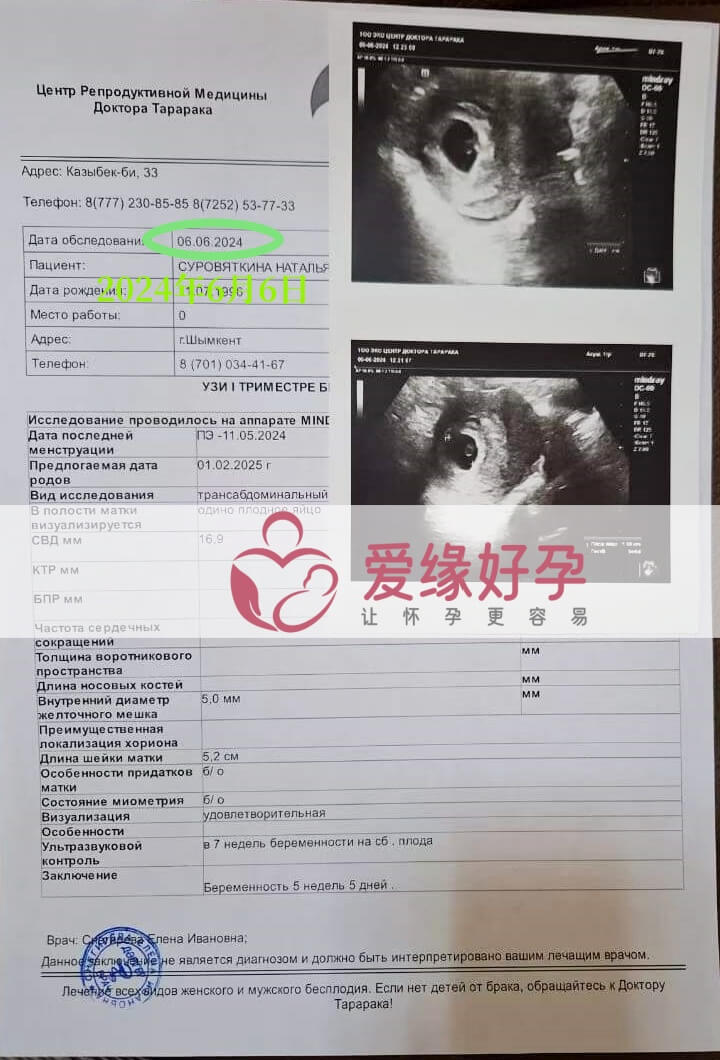 爱缘好孕:哈萨克斯坦代孕代母第一次B超检查顺利通过