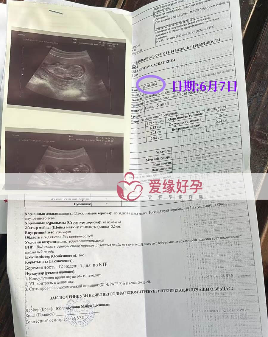 爱缘好孕:哈萨克斯坦代孕代母孕12周产检顺利通过