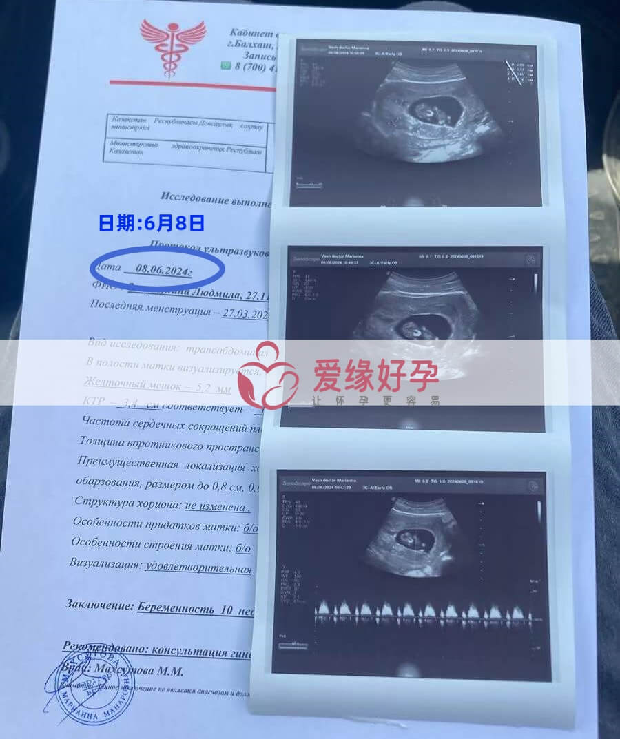 爱缘好孕:哈萨克斯坦代孕代母孕10周产检顺利通过