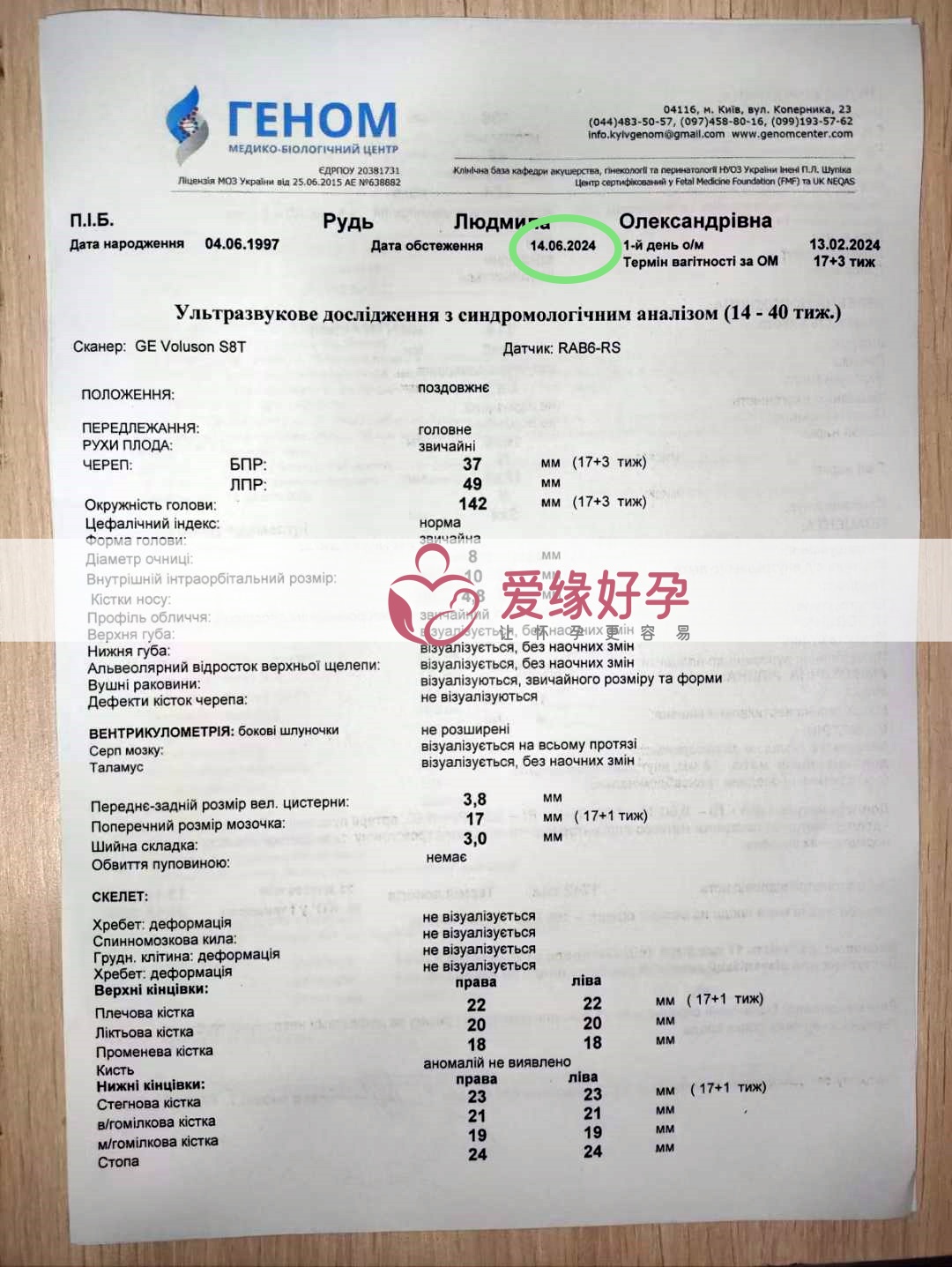 爱缘好孕:乌克兰代孕代母孕17周产检顺利通过