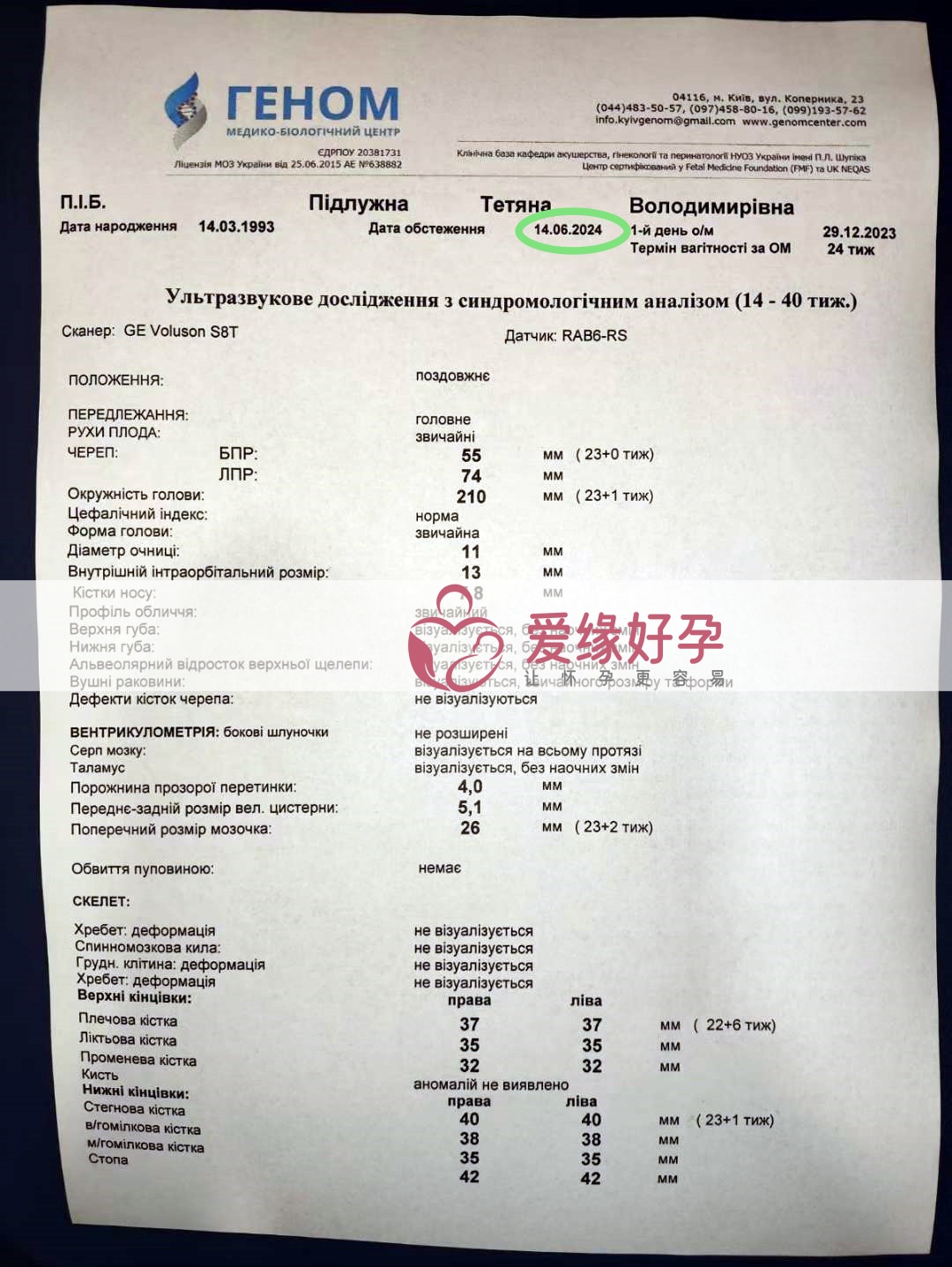 爱缘好孕:乌克兰代孕代母孕23周产检顺利通过