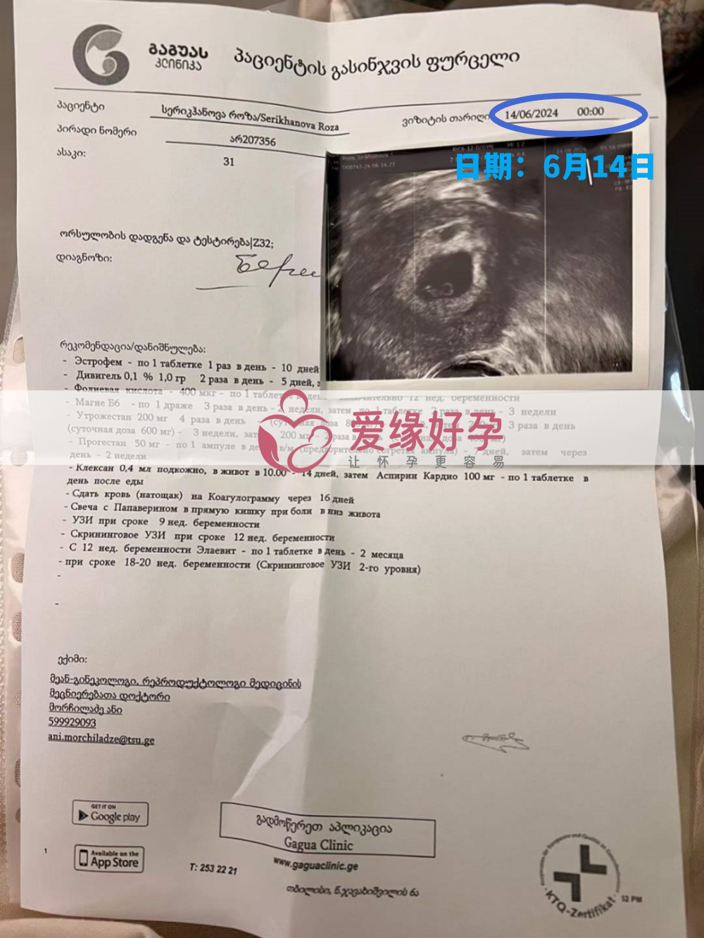 爱缘好孕:格鲁吉亚代孕代母第一次B超产检顺利通过