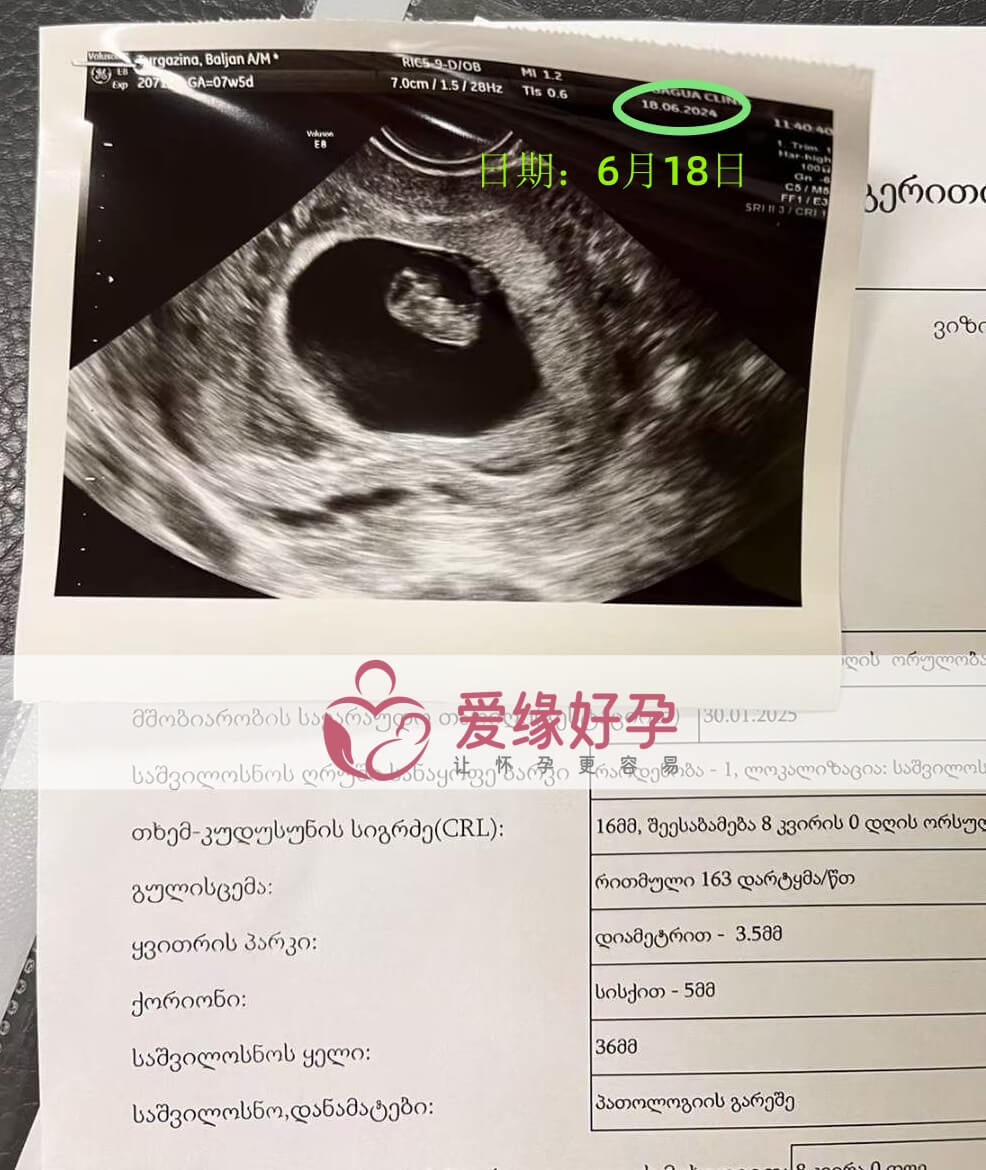 爱缘好孕格鲁吉亚代孕代母孕8周产检顺利通过