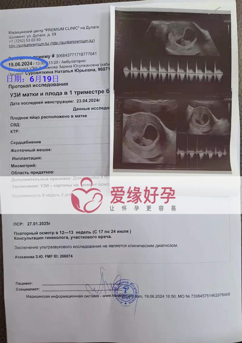 爱缘好孕哈萨克斯坦代孕代母孕8周产检顺利通过