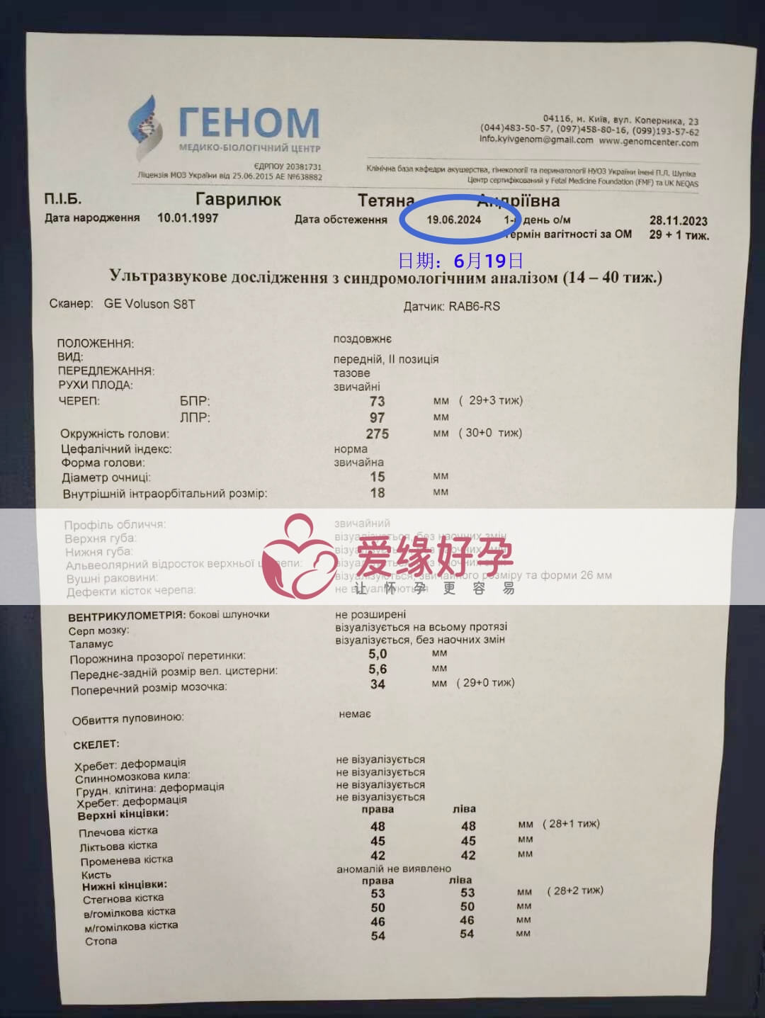 爱缘好孕乌克兰代孕代母孕28周产检顺利通过