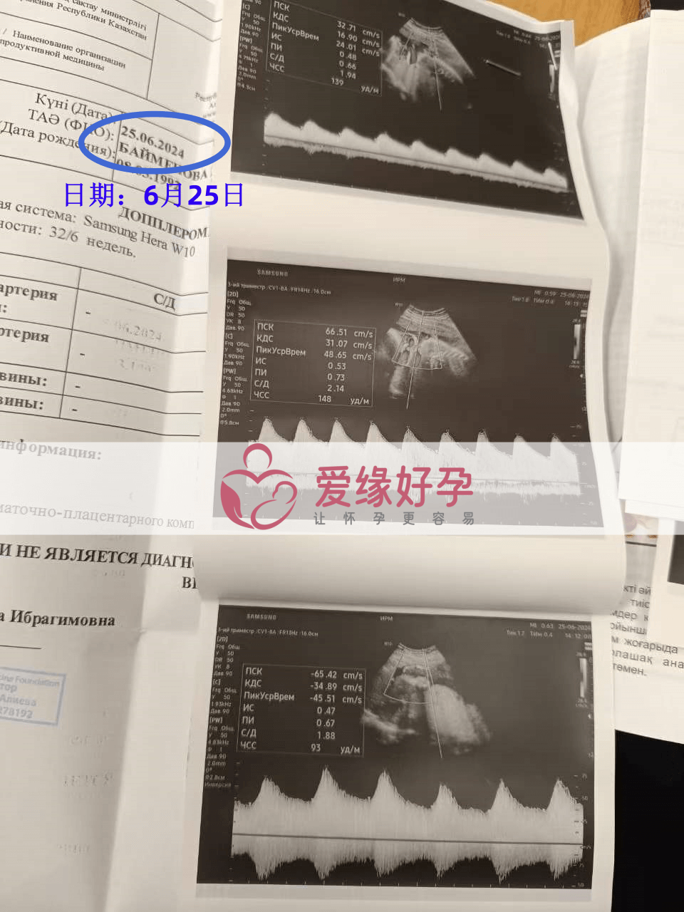 爱缘好孕哈萨克斯坦代孕代母孕33周产检顺利通过