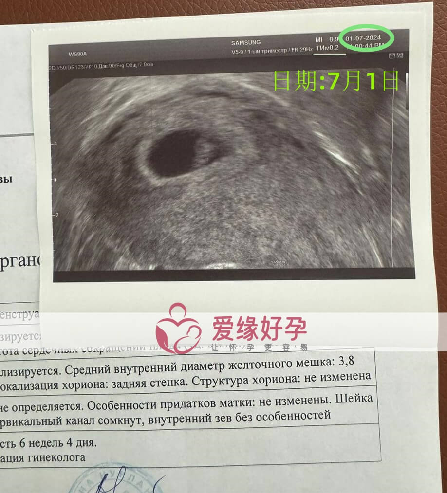 爱缘好孕哈萨克斯坦代孕代母孕6周产检顺利通过