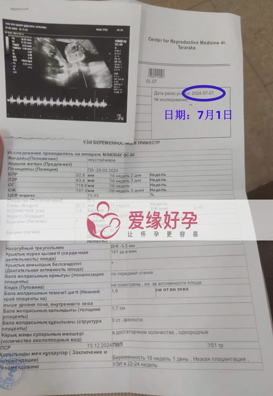 爱缘好孕哈萨克斯坦代孕代母孕16周产检顺利通过