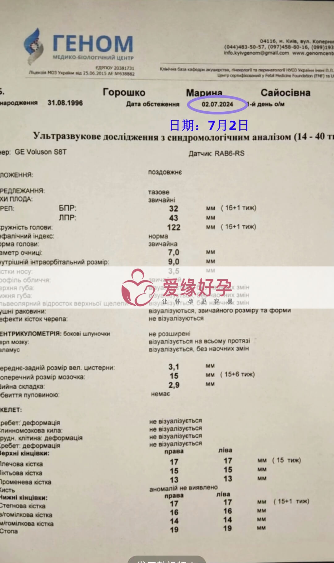 爱缘好孕乌克兰代孕代母孕15周产检顺利通过