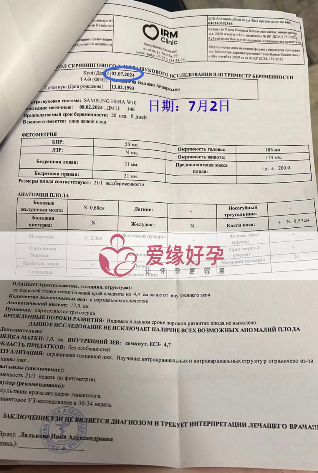 爱缘好孕哈萨克斯坦代孕代母孕20周产检顺利通过
