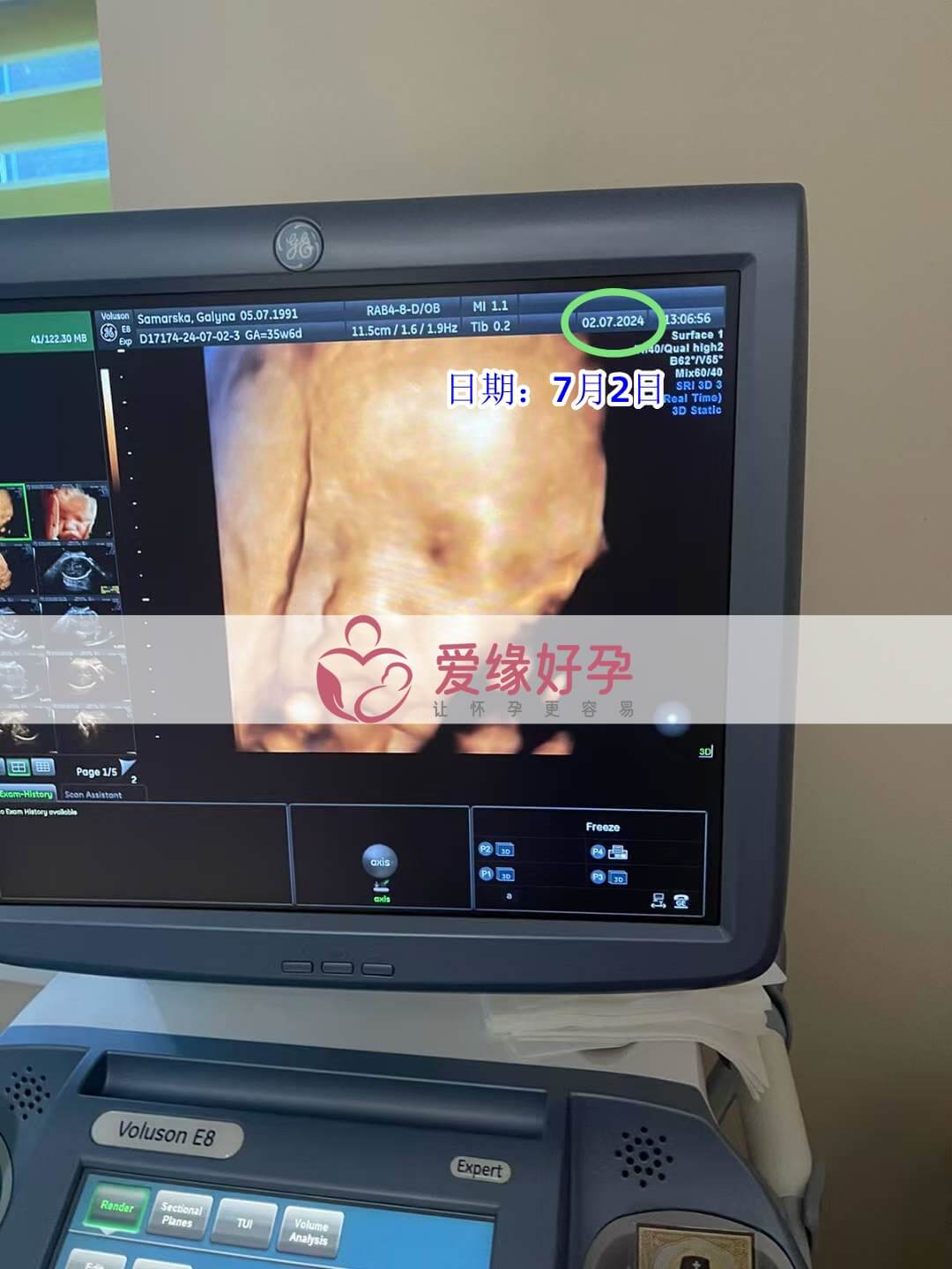 爱缘好孕乌克兰代孕代母孕36周产检顺利通过