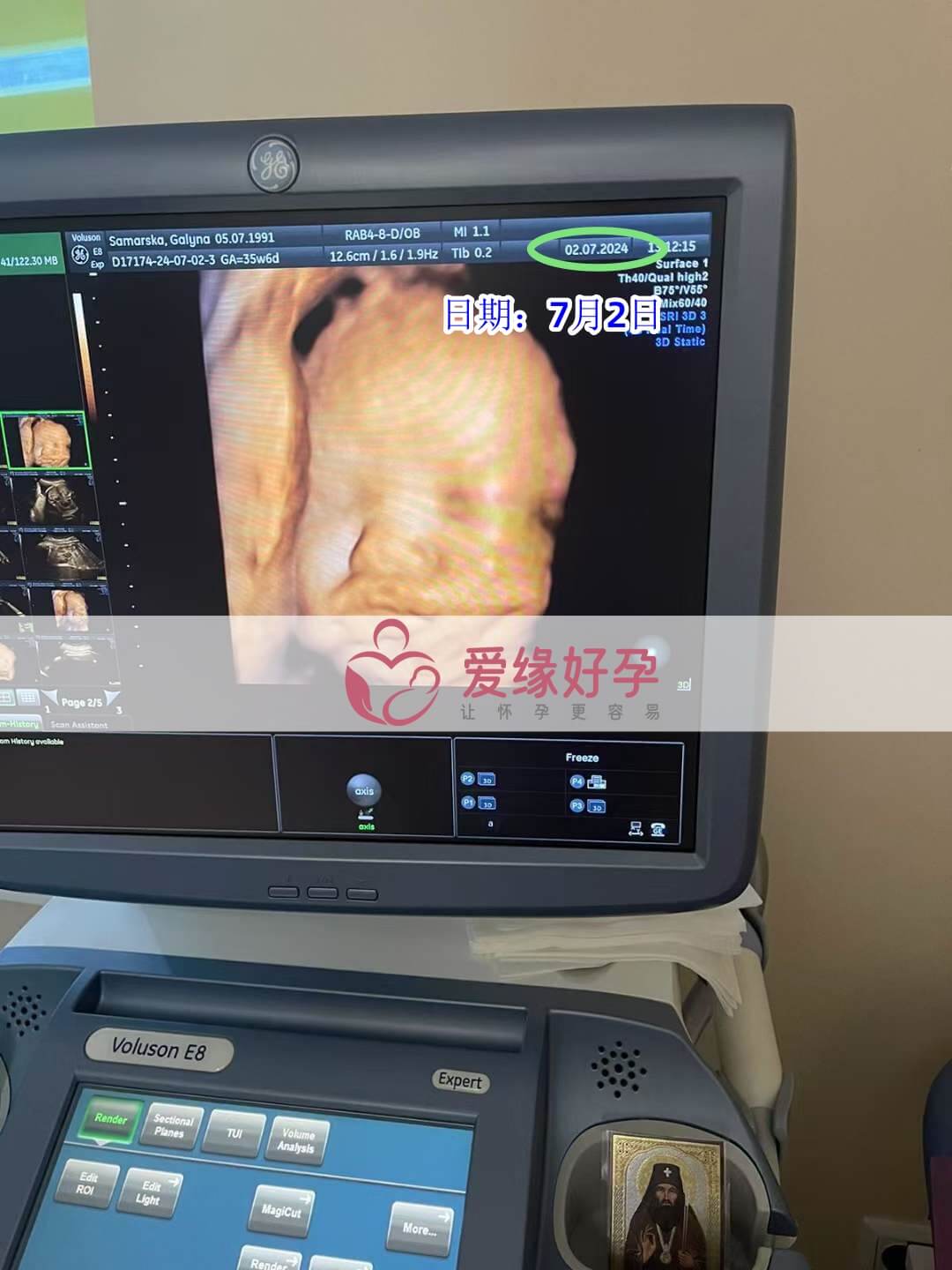 爱缘好孕乌克兰代孕代母孕36周产检顺利通过