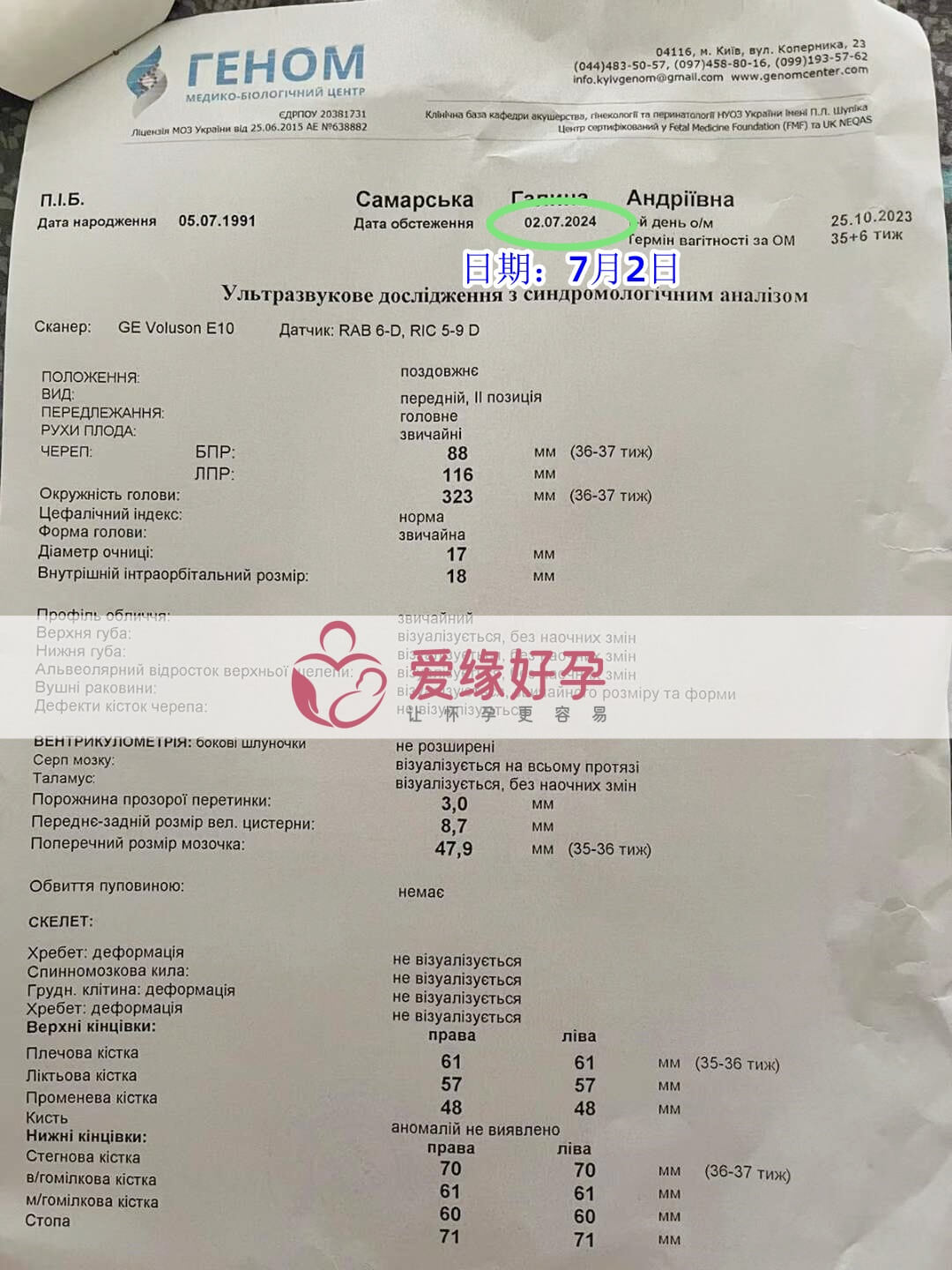 爱缘好孕乌克兰代孕代母孕36周产检顺利通过