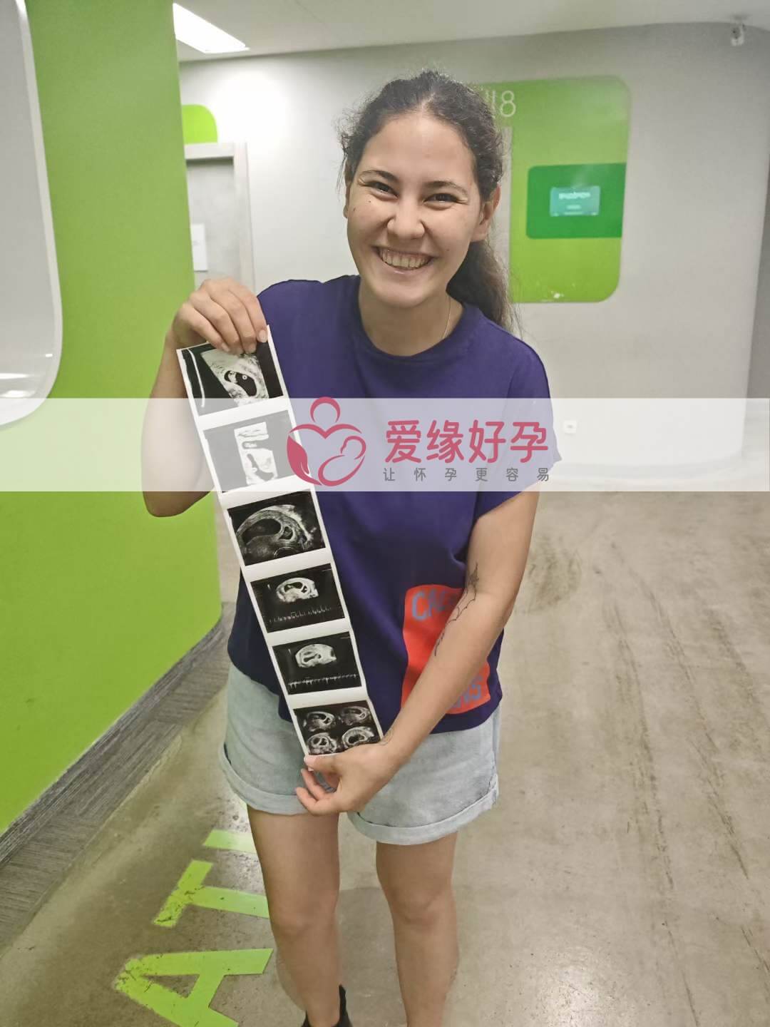 爱缘好孕格鲁吉亚代孕代母孕8周产检顺利通过