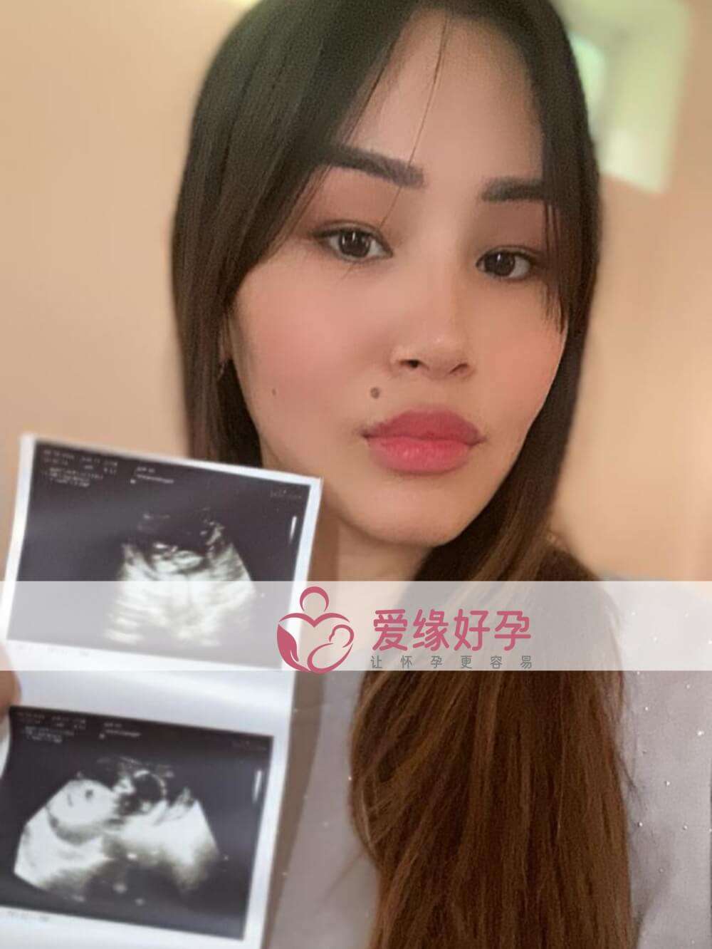 爱缘好孕哈萨克斯坦代孕代母孕17周产检顺利通过