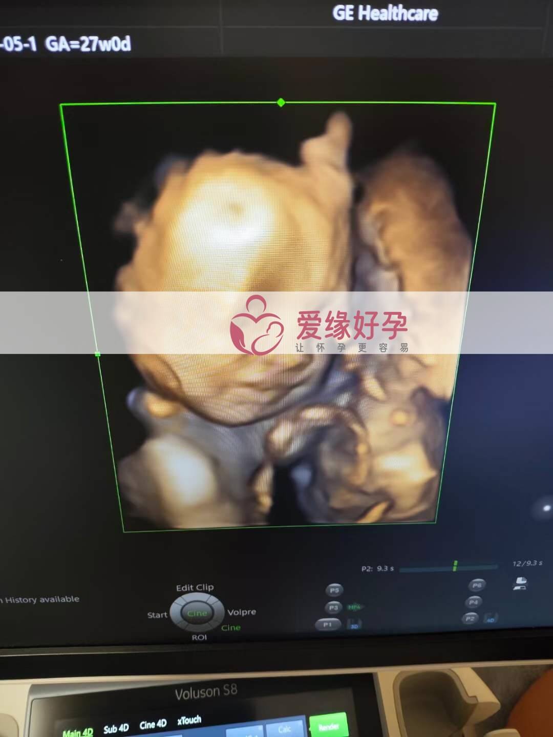 爱缘好孕乌克兰代孕代母孕27周产检顺利通过