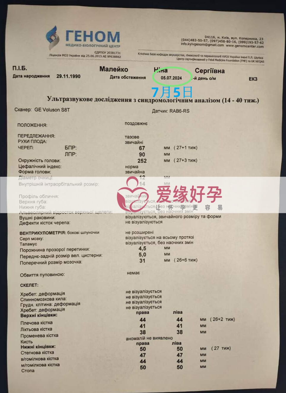 爱缘好孕乌克兰代孕代母孕27周产检顺利通过