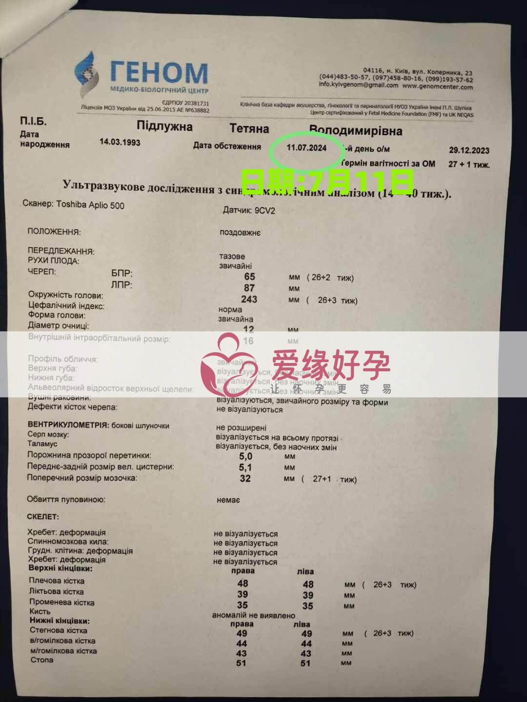 爱缘好孕乌克兰代孕代母26周产检顺利通过