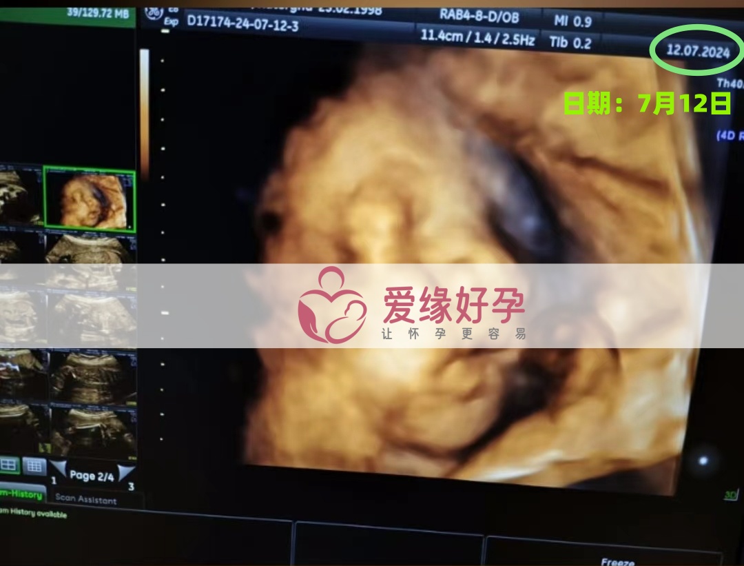 爱缘好孕乌克兰代孕代母孕27周产检顺利通过