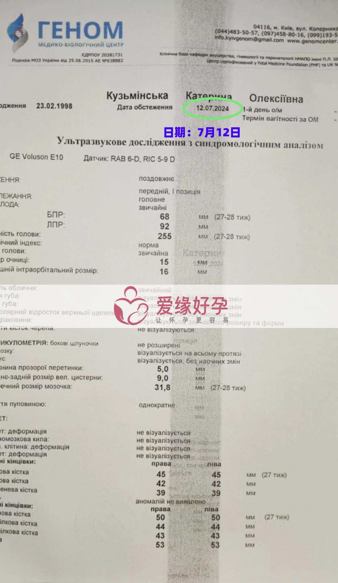 爱缘好孕乌克兰代孕代母孕27周产检顺利通过