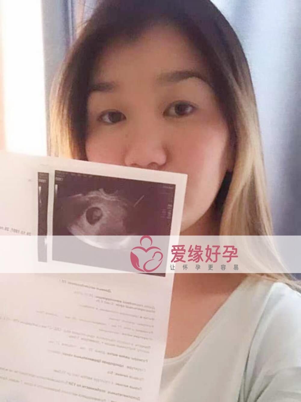 爱缘好孕哈萨克斯坦代孕代母孕7周产检顺利通过