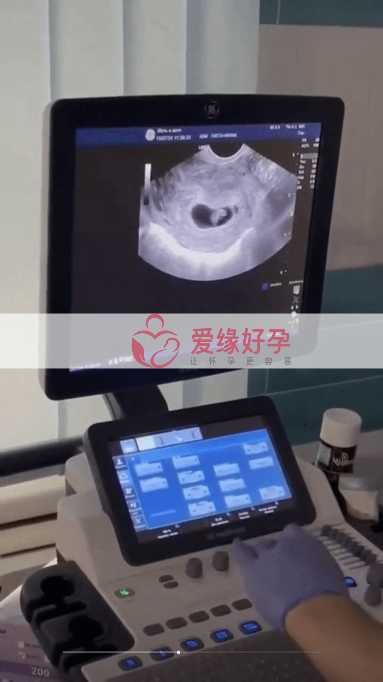 爱缘好孕乌克兰代孕代母孕6周产检顺利通过