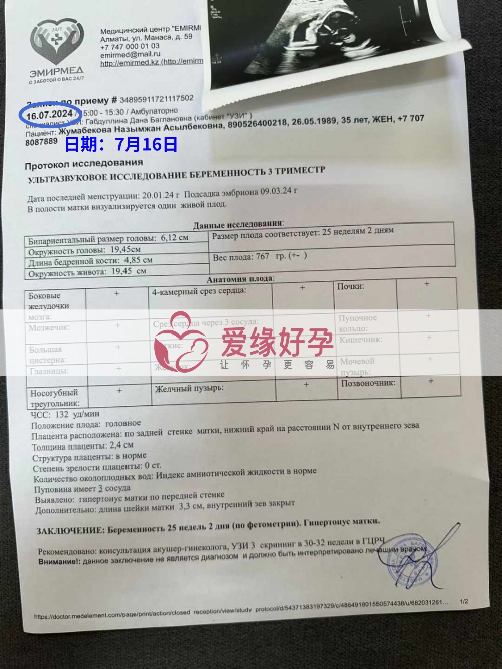 爱缘好孕哈萨克斯坦代孕代母孕25周产检顺利通过