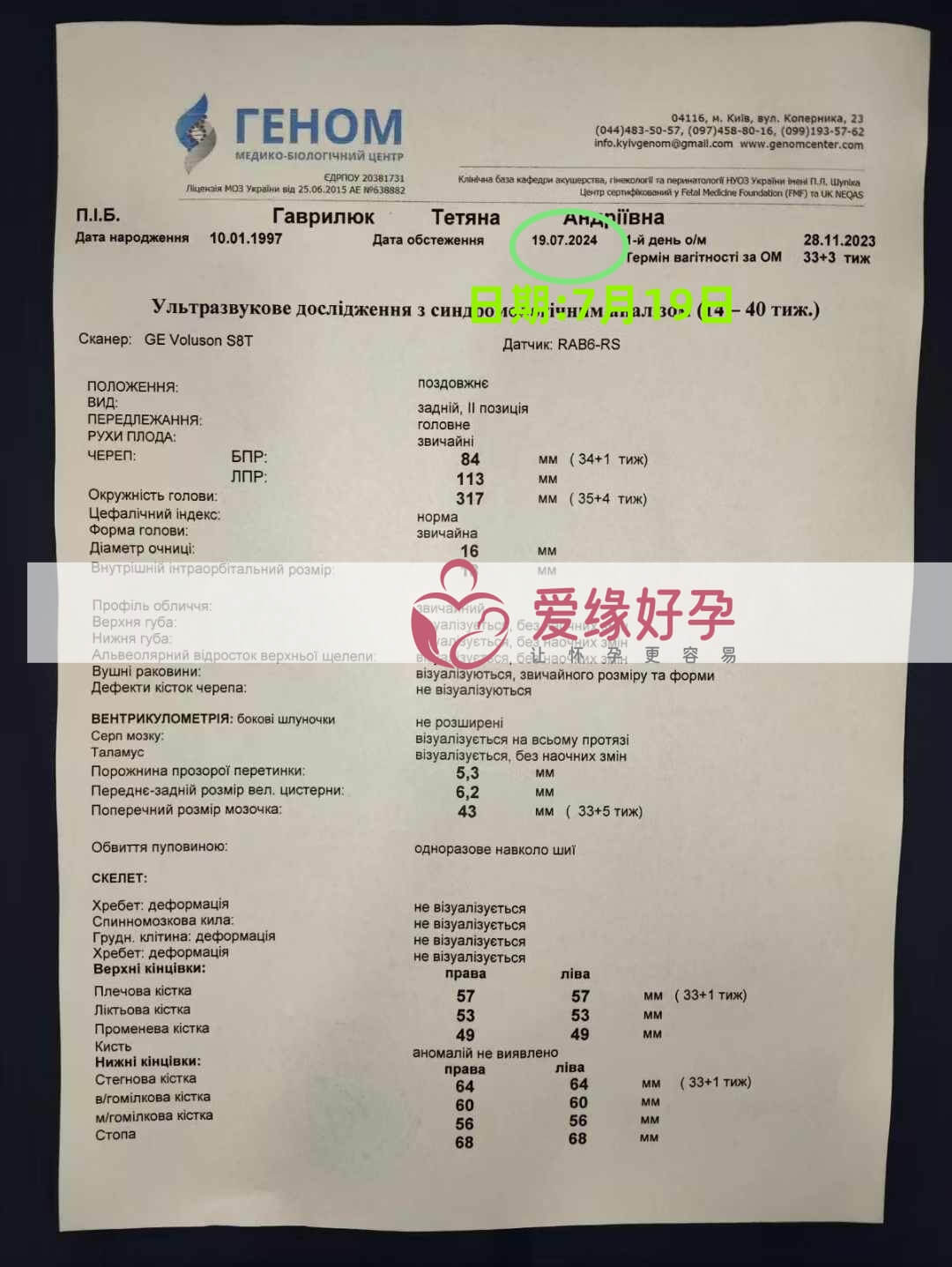 爱缘好孕乌克兰代孕代母孕34周产检顺利通过