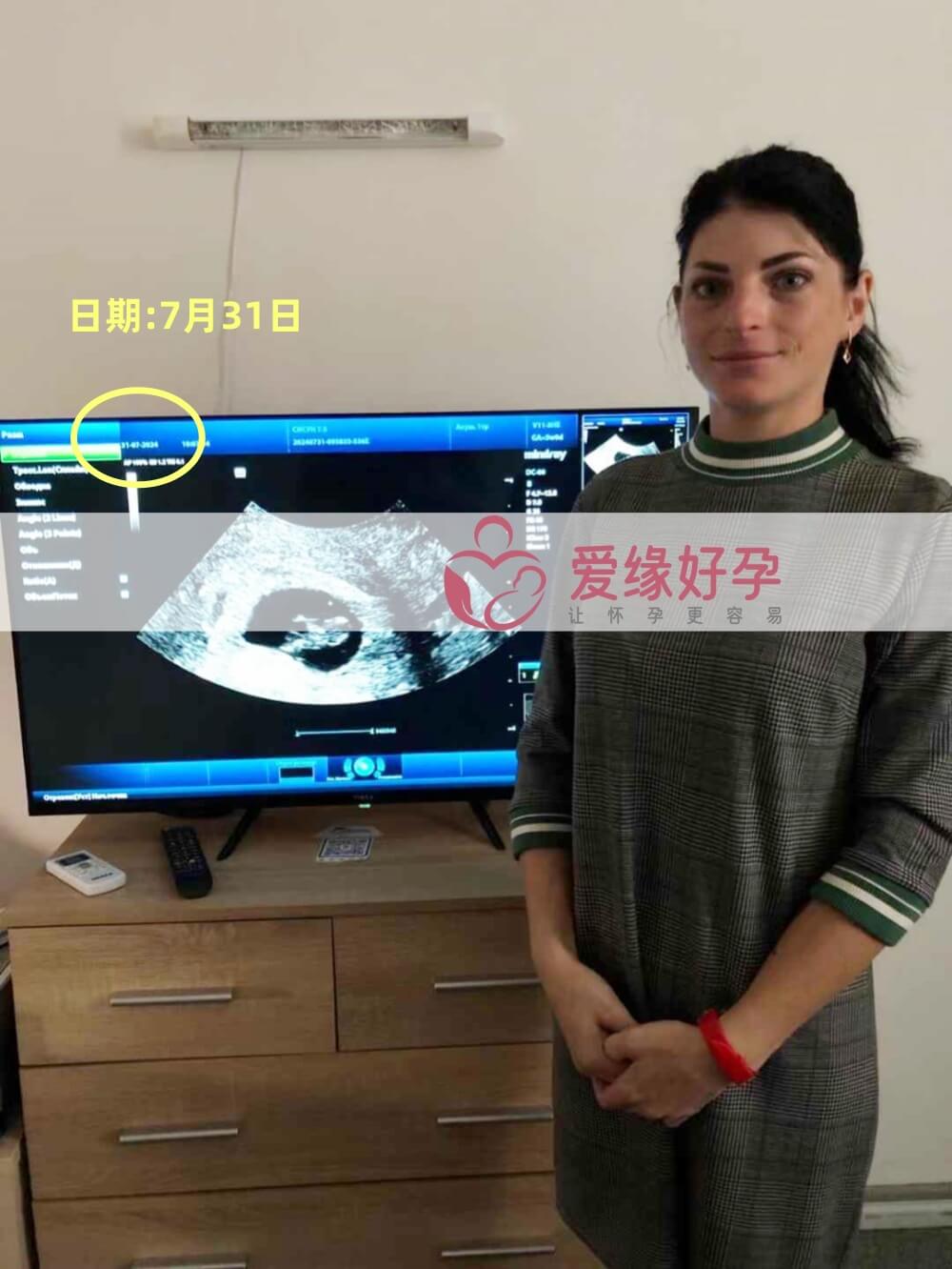爱缘好孕乌克兰代孕代母孕7周产检顺利通过