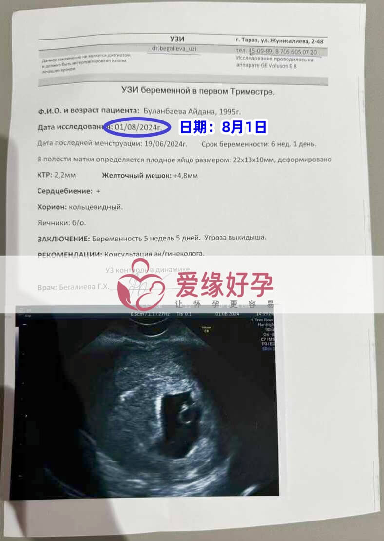 爱缘好孕哈萨克斯坦代孕代母B超产检顺利通过