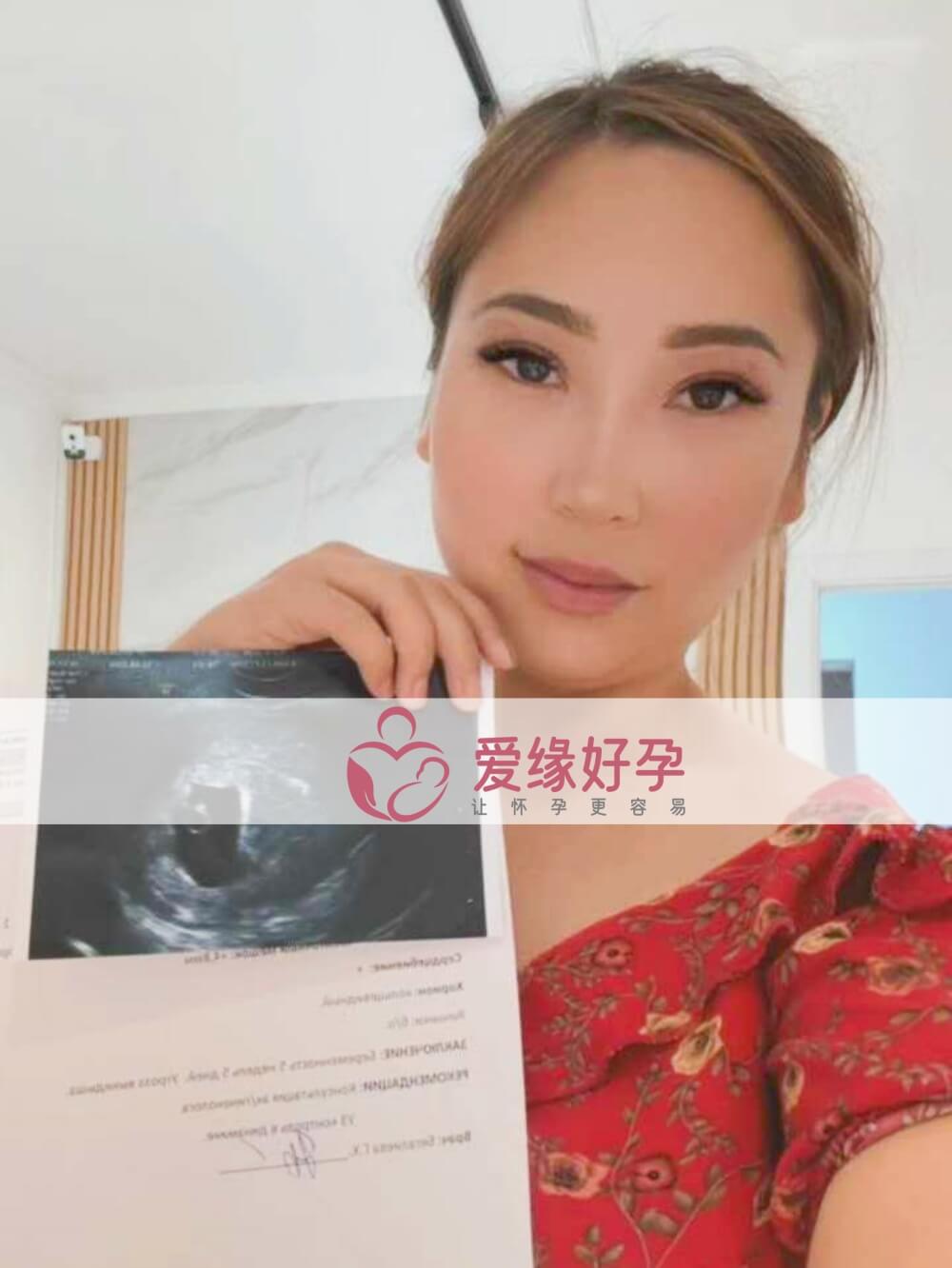 爱缘好孕哈萨克斯坦代孕代母B超产检顺利通过